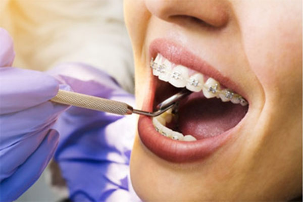 Reasons-for-visiting-an-orthodontist.jpg