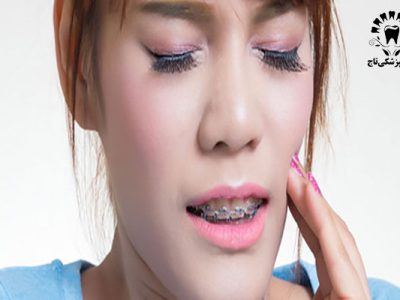 راهکارهایی جهت کاهش درد ارتودنسی دندان