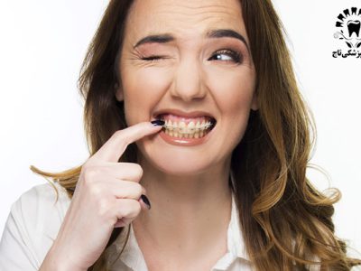 آیا احتمال شکست ارتودنسی دندان وجود دارد؟
