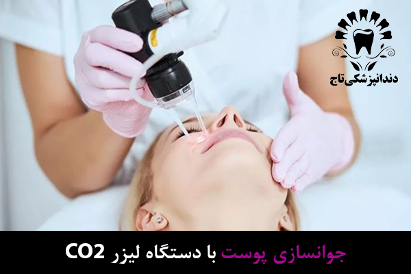 جوانسازی پوست با دستگاه لیزر CO2